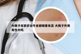 大枫子皮肤舒治牛皮癣哪里有卖 大枫子外用毒性大吗