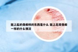 腿上起的像癣样的东西是什么 腿上出现像癣一样的什么情况