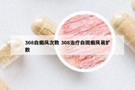 308白癜风次数 308治疗白斑癜风易扩散