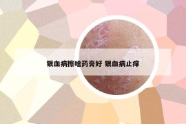 银血病擦啥药膏好 银血病止痒