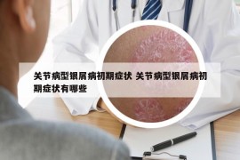 关节病型银屑病初期症状 关节病型银屑病初期症状有哪些