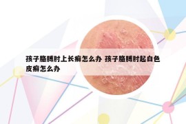 孩子胳膊肘上长癣怎么办 孩子胳膊肘起白色皮癣怎么办