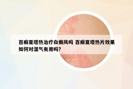 百癣夏塔热治疗白癜风吗 百癣夏塔热片效果如何对湿气有用吗?