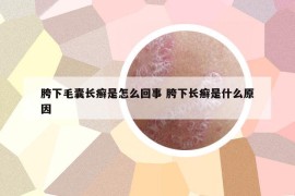 胯下毛囊长癣是怎么回事 胯下长癣是什么原因