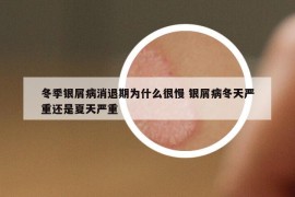 冬季银屑病消退期为什么很慢 银屑病冬天严重还是夏天严重