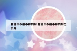 背部长不痛不痒的癣 背部长不痛不痒的癣怎么办