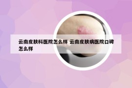 云南皮肤科医院怎么样 云南皮肤病医院口碑怎么样