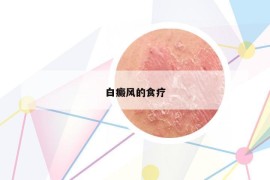 白癜风的食疗