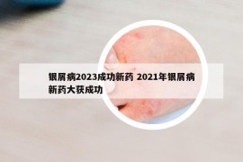 银屑病2023成功新药 2021年银屑病新药大获成功