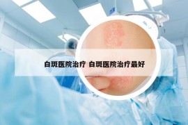 白斑医院治疗 白斑医院治疗最好