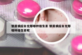 银屑病应补充那哪种维生素 银屑病应补充那哪种维生素呢