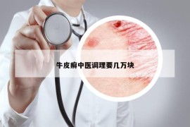 牛皮癣中医调理要几万块