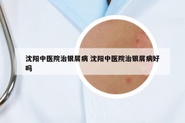 沈阳中医院治银屑病 沈阳中医院治银屑病好吗