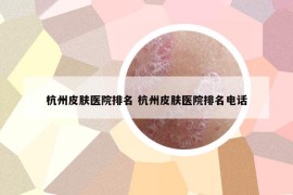 杭州皮肤医院排名 杭州皮肤医院排名电话