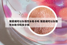 银屑病可以办慢性补助卡吗 银屑病可以办慢性补助卡吗多少钱