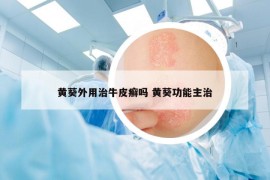 黄葵外用治牛皮癣吗 黄葵功能主治