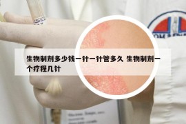 生物制剂多少钱一针一针管多久 生物制剂一个疗程几针