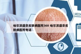 哈尔滨盛京皮肤病医院360 哈尔滨盛京皮肤病医院电话