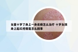 女童十岁了身上一身皮癣怎么治疗 十岁女孩身上起红疙瘩是怎么回事