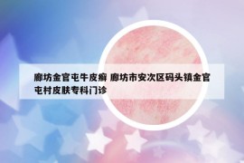 廊坊金官屯牛皮癣 廊坊市安次区码头镇金官屯村皮肤专科门诊