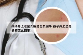 孩子身上老是长癣是怎么回事 孩子身上总是长癣怎么回事