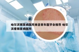 哈尔滨银屑病医院来咨青年医学会推荐 哈尔滨看银屑病医院