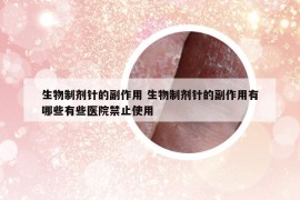 生物制剂针的副作用 生物制剂针的副作用有哪些有些医院禁止使用