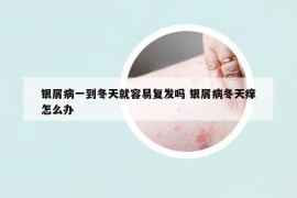 银屑病一到冬天就容易复发吗 银屑病冬天痒怎么办