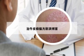 治牛皮癣偏方新浪博客