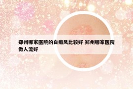 郑州哪家医院的白癜风比较好 郑州哪家医院做人流好