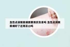 急性点滴银屑病需要用抗生素吗 急性点滴银屑病好了还用忌口吗