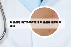 银屑病可以打麻疹疫苗吗 银屑病能打麻风疫苗吗