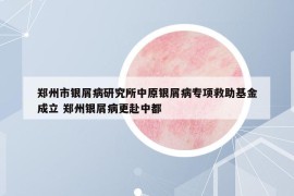 郑州市银屑病研究所中原银屑病专项救助基金成立 郑州银屑病更赴中都