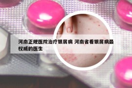 河南正规医院治疗银屑病 河南省看银屑病最权威的医生