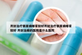 开封治疗银屑病哪家较好开封治疗银屑病哪家较好 开封治癣的医院是什么医院