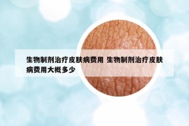 生物制剂治疗皮肤病费用 生物制剂治疗皮肤病费用大概多少