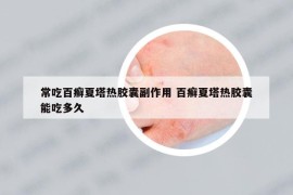 常吃百癣夏塔热胶囊副作用 百癣夏塔热胶囊能吃多久