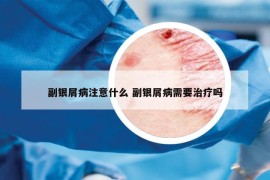 副银屑病注意什么 副银屑病需要治疗吗