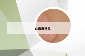 白癜风泛发