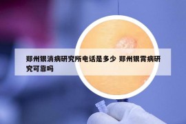 郑州银消病研究所电话是多少 郑州银霄病研究可靠吗