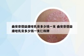 曲安奈德益康唑乳膏多少钱一支 曲安奈德益康唑乳膏多少钱一支仁和牌