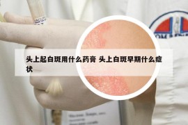 头上起白斑用什么药膏 头上白斑早期什么症状