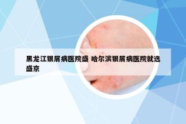 黑龙江银屑病医院盛 哈尔滨银屑病医院就选盛京