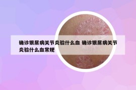 确诊银屑病关节炎验什么血 确诊银屑病关节炎验什么血常规