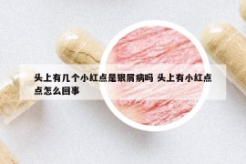 头上有几个小红点是银屑病吗 头上有小红点点怎么回事