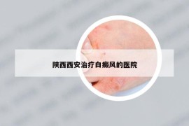 陕西西安治疗白癜风的医院