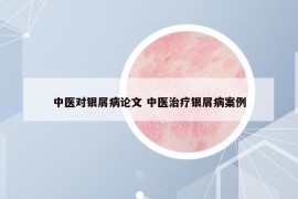 中医对银屑病论文 中医治疗银屑病案例