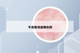 牛皮癣消退期白斑