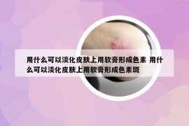 用什么可以淡化皮肤上用软膏形成色素 用什么可以淡化皮肤上用软膏形成色素斑