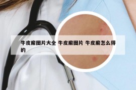 牛皮廨图片大全 牛皮廨图片 牛皮廨怎么得的